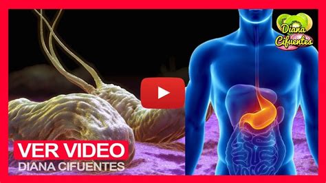 Helicobacter Pylori Tratamiento Natural Para La Bacteria H Pylori En