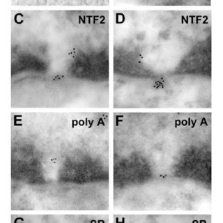 Electron Micrographs Of Nuclear Pores In Rat Liver Cells Hepatoctyes