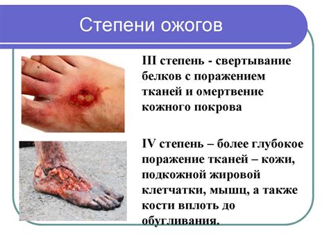 Первая помощь при повреждениях кожи, тепловом и солнечном ударах. 9 ...