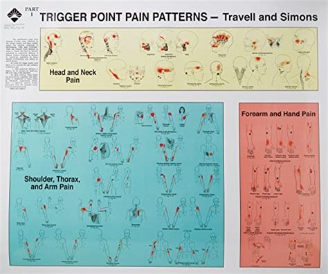 Trigger Point Pain Patterns – Free Patterns