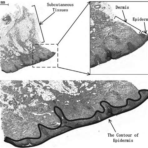 anatomy   skin tissue  scientific diagram