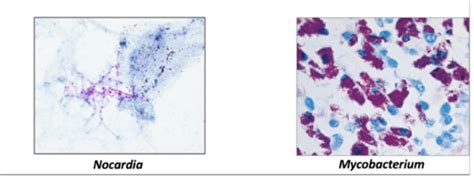 L Atypical Bacteria Flashcards Quizlet