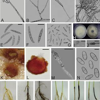 Pdf Fusarium Paranaense Sp Nov A Member Of The Fusarium Solani