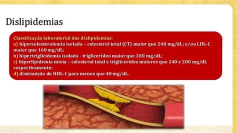 Fármacos Para Tratamento Das Dislipidemias