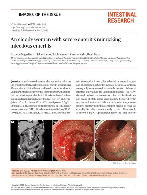 Pdf An Elderly Woman With Severe Enteritis Mimicking Infectious Enteritis