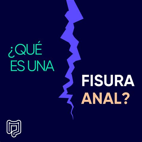 Fisura Anal Dr Luis Enrique Sánchez
