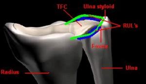 Fovea Sign - Physiopedia