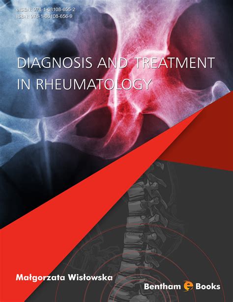 Diagnosis And Treatment In Rheumatology