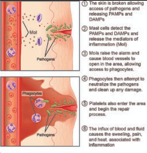 mekanisme reaksi inflamasi  peradangan repro note