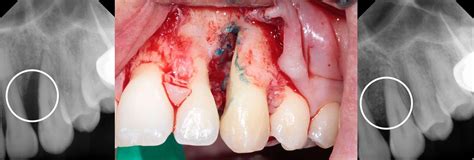 Procedimentos periodontais WR Instituto Odontológico