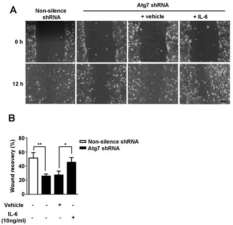 Knockdown Of Atg7 Inhibited Migration Of Brain Microvascular