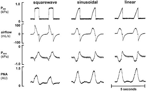 Representative cycles of assist/control ventilation with square wave ...