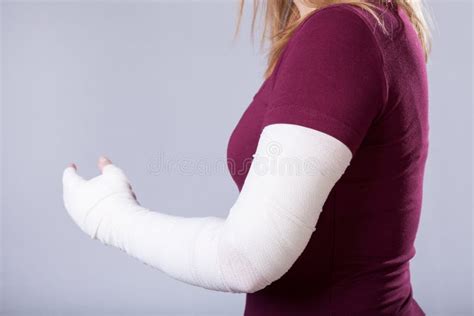 17436 Broken Arm Stock Photos Free And Royalty Free Stock Photos From