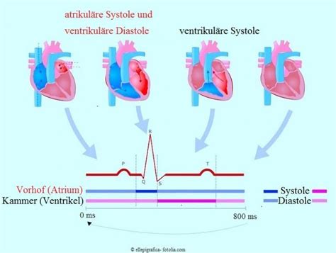 Herzger Usch Symptome Kinder Kardial Systolikum S Ugling