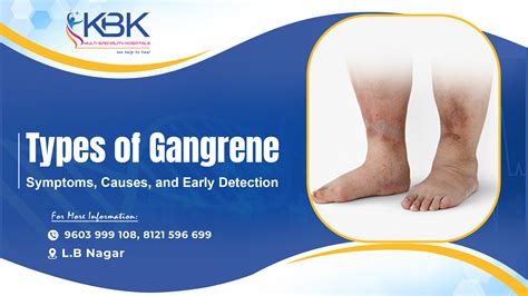 types  gangrene symptoms   early detection