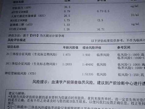 21三体综合征 临界风险、正常范围、治疗方法大全 孕小帮