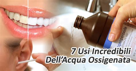 Incredibili Usi Dellacqua Ossigenata Che Ti Lasceranno Senza Parole