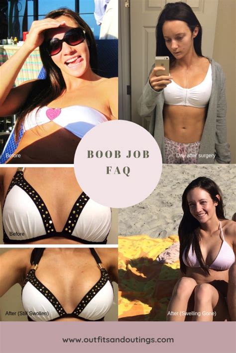Boob Job FAQ Everything You Need To Know Outfits Outings