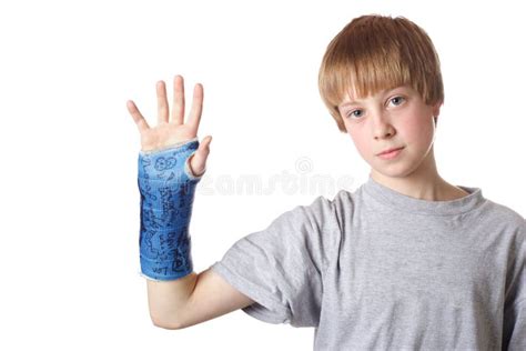 Broken wrist stock photo. Image of cast, people, male - 4323420