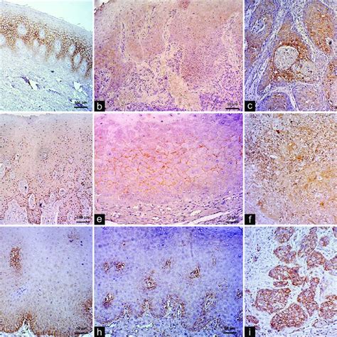 Immunoexpression Of E Cadherin N Cadherin And Caveolin During Stages