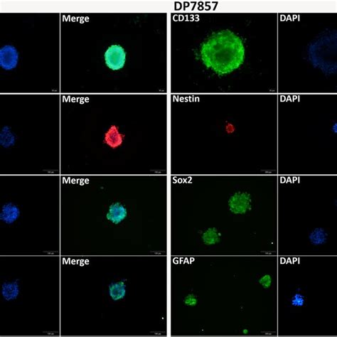 Immunofluorescence Staining Of The Glioma Stem Cell Spheres