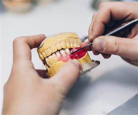 Denture Repairs Gold Coast Relines South Coast Denture Clinic