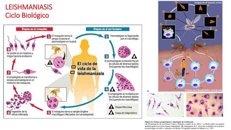 Clase 71 Enfermedades Parasitarias YouTube