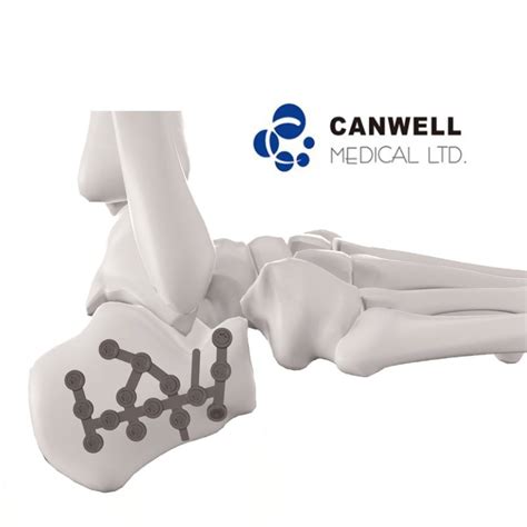 Canwell Medical Orthopedic Posterior Tuberosity Medical Calcaneal Plate