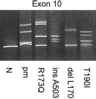 DGGE Analysis Of Exon 10 Of The PBGD Gene Four Different Mutation