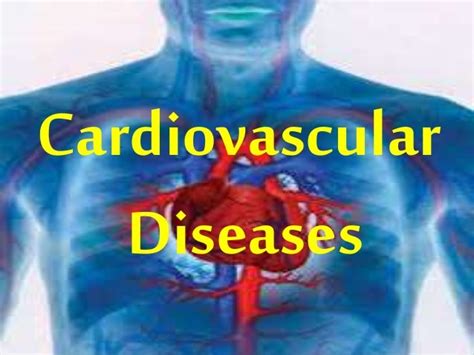 Cardiovascular diseases