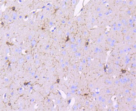 Pdgf Receptor Beta Rabbit Mab Sab Signalway Antibody