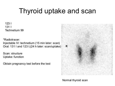 Thyroid