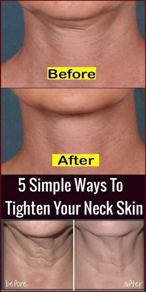 5 Simple Ways To Tighten Your Neck Skin | Tighten loose skin, Tighten ...