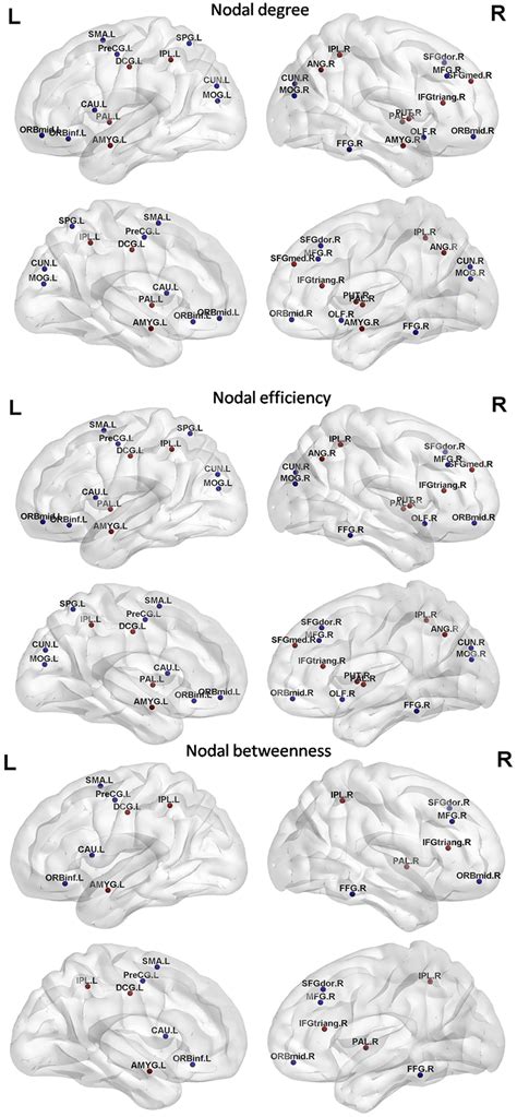 Brain Regions Showing Significant Alterations In Nodal Centrality