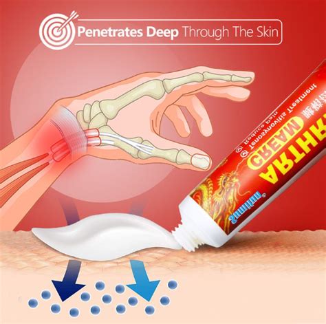 Arthritis Cream Muscle Pain Pengobatan Untuk Mengurangi Rasa Sakit