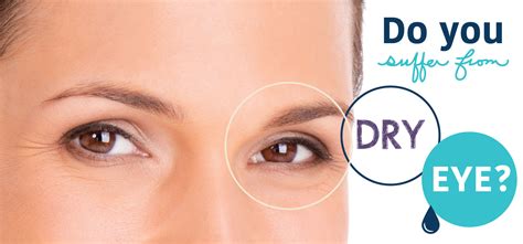 dry eye treatment plans midwest eye consultants