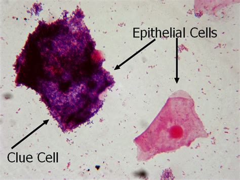 Clue Cell Wikipedia