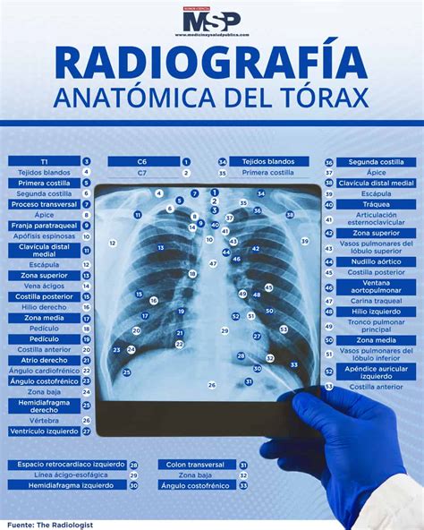 Radiografía anatomía del tórax Infografía