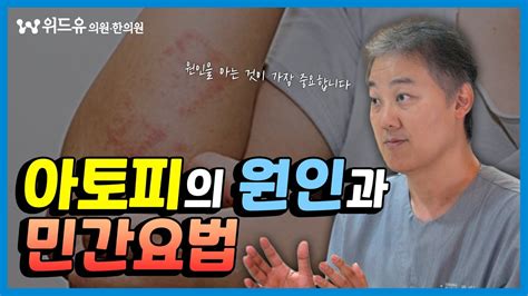 아토피 치료 하시는 분들 주목🔍 아토피 정확한 원인 파악과 민간요법 치료에 대한 자세한 이야기 Youtube