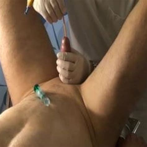 Blasenkatheter Legen Free Gay Porn Video 29 XHamster XHamster