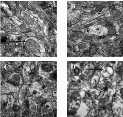 Rat hippocampal CA1 nerve cells (TEM). A: 0.0 g/L AlCl3; B: 2.0 g/L ... 