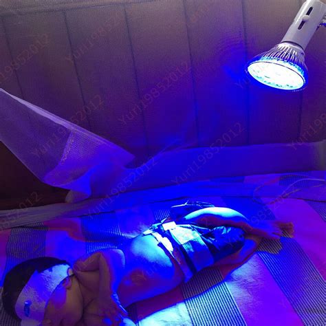 Nm Watts Baby Care Neonatal Jaundice Phototherapy Led Blue Ray