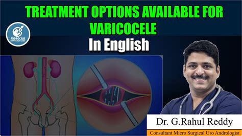 Treatment Options Available For Varicocele Dr Rahul Reddy