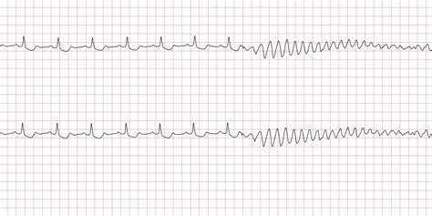 11 Ecg Disount Deals | www.gbu-hamovniki.ru