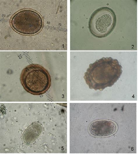 Huevos De Nematodos Obtenidos Por Flotaci N Toxocara Cati