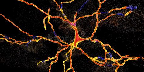 Degeneraci N De La Neurona Dopamin Rgica Una Etapa Dominante Del