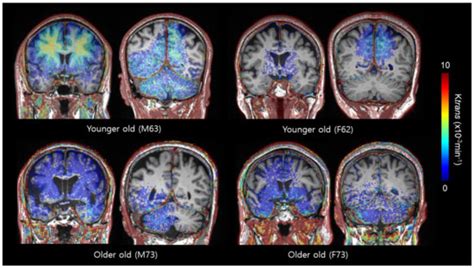 Ijms Free Full Text Sex Related Differences In Regional Bloodbrain