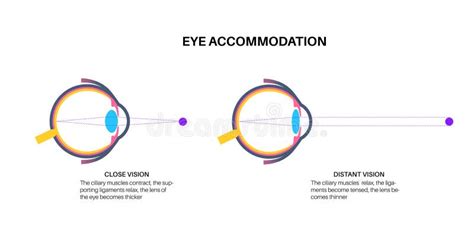 Eye Accommodation Poster Stock Vector Illustration Of Body 303002019