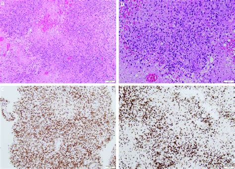 Histopathology Slides A Haematoxylin And Eosin Stain ×10 Download Scientific Diagram