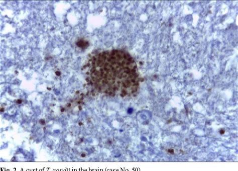 Figure 2 From Prevalence Of Toxoplasma Gondii Infection In Brain And Heart By